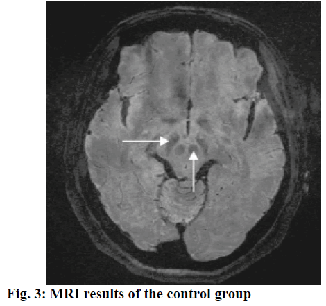 IJPS-control-group