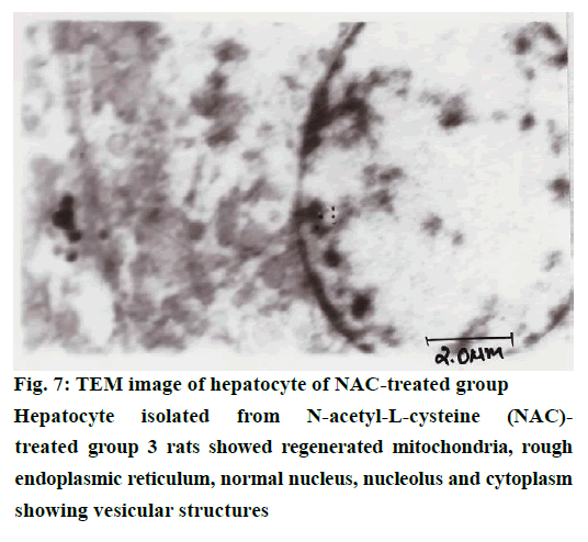 IJPS-endoplasmic-reticulum