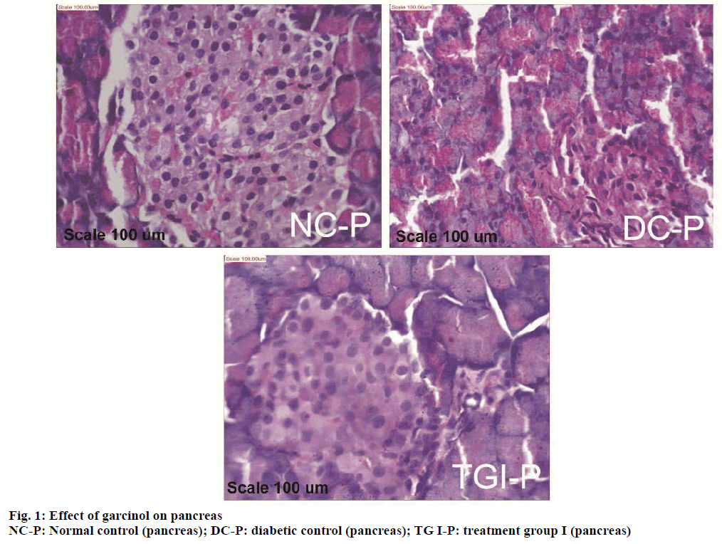 IJPS-garcinol-pancreas