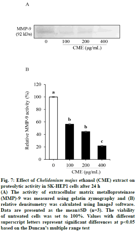 IJPS-gelatin-zymography