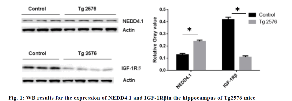 IJPS-hippocampus