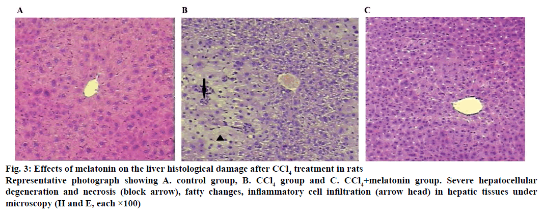 IJPS-histological-damage