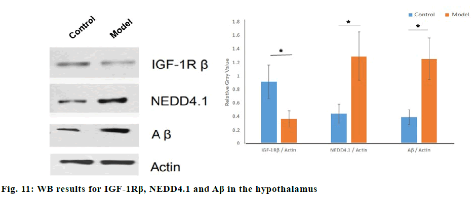 IJPS-hypothalamus