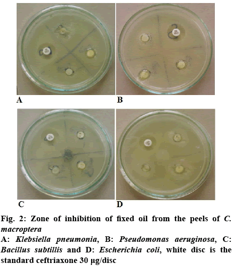 IJPS-inhibition