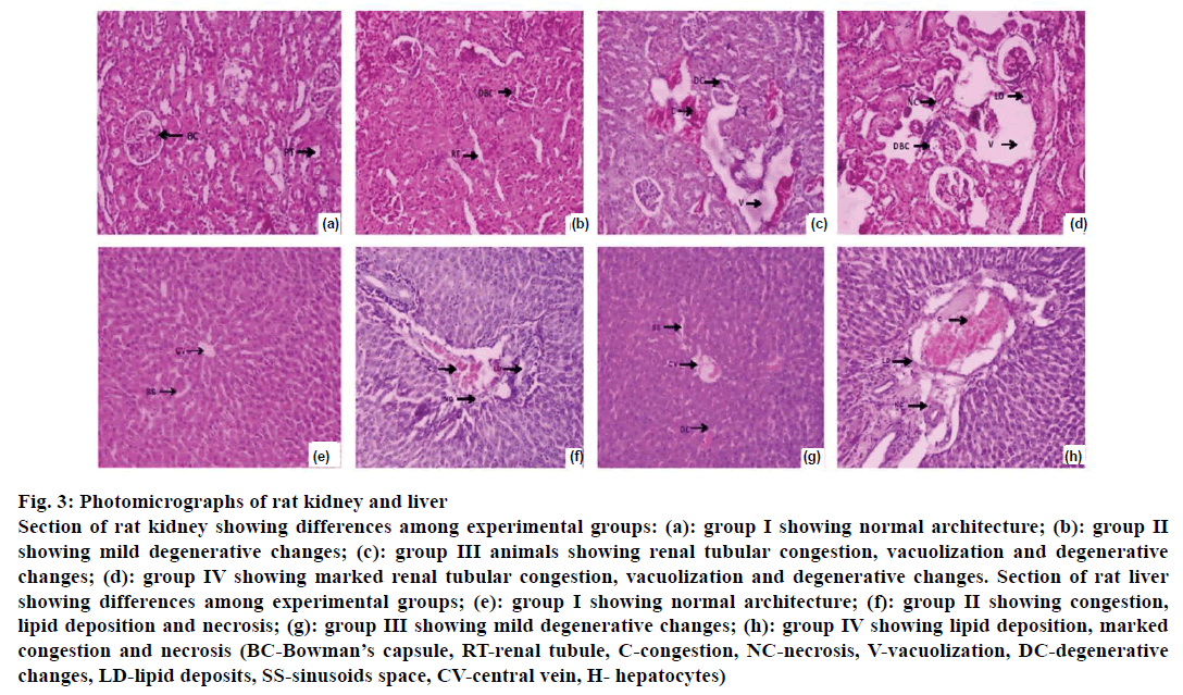 IJPS-kidney-liver