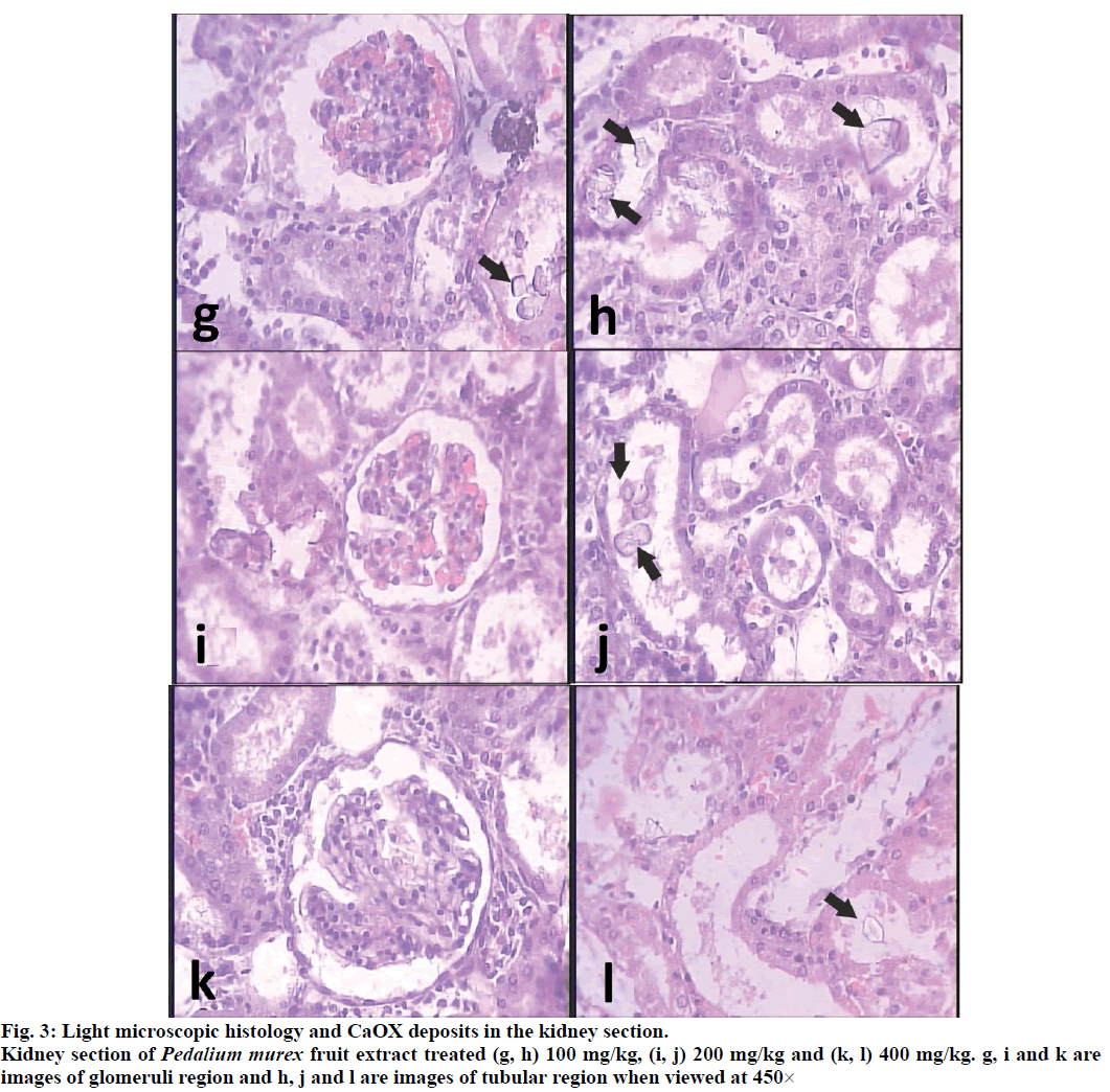 IJPS-kidney-section