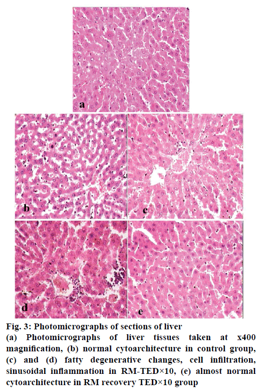 IJPS-liver-tissues-taken