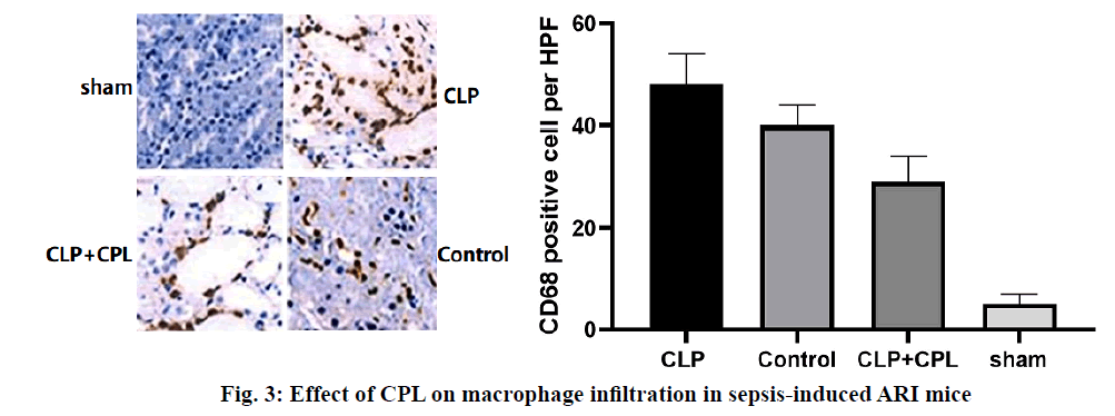 IJPS-macrophage