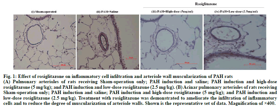 IJPS-muscularization