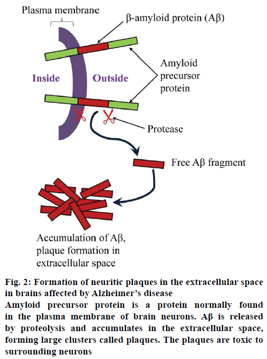 IJPS-neuritic-plaques