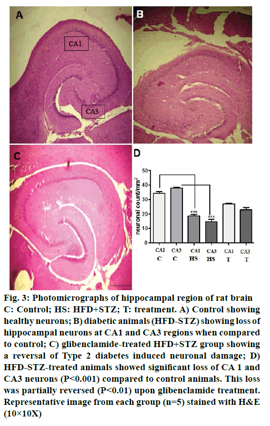 IJPS-neuronal-damage