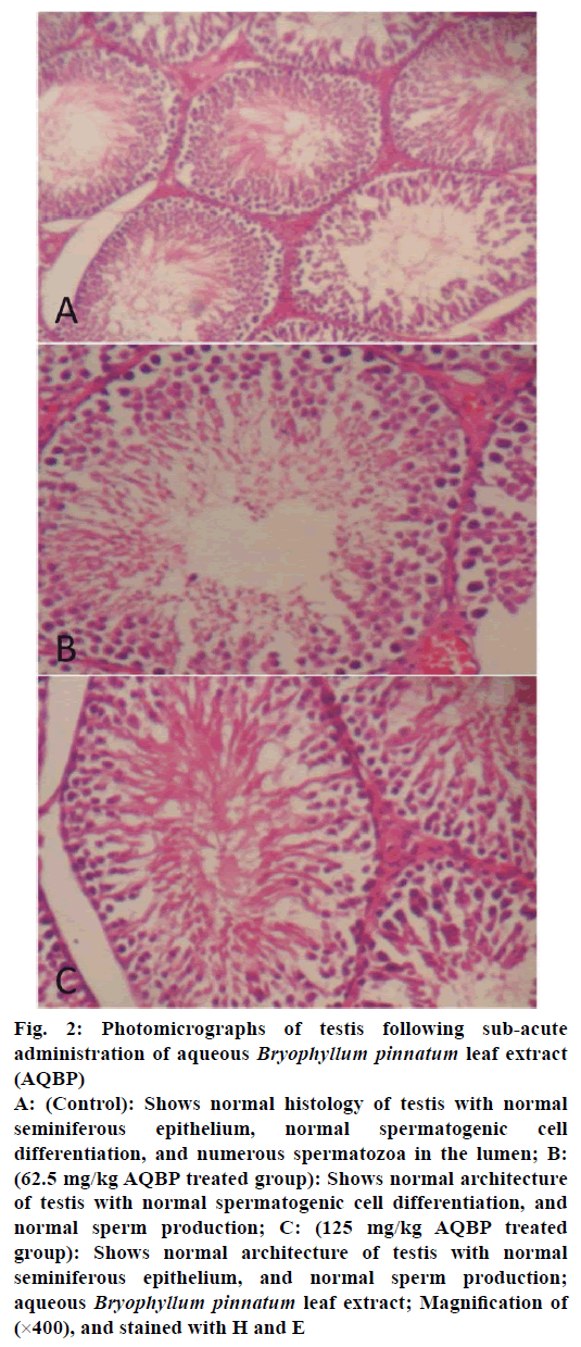 IJPS-normal-spermatogenic-cell