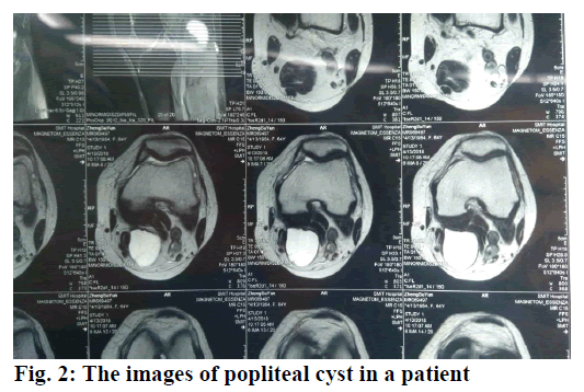 IJPS-patient