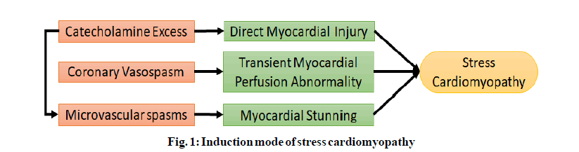 IJPS-stress-cardiomyopathy