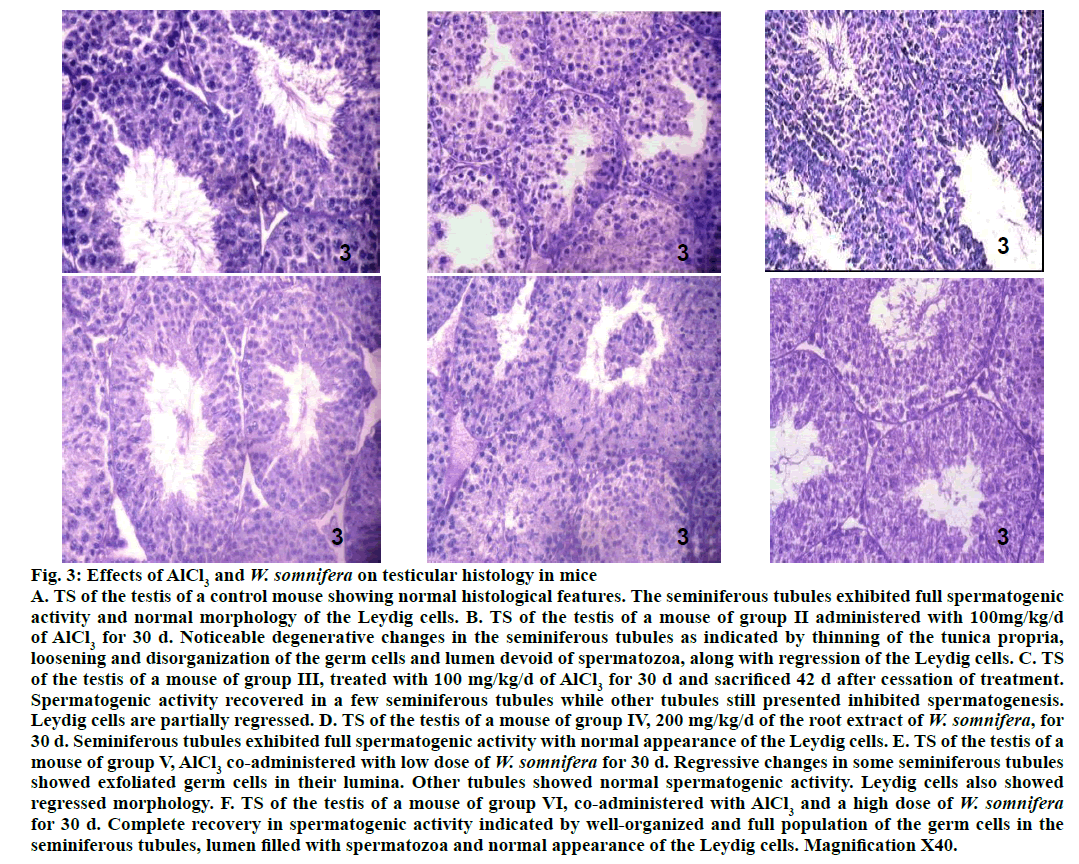 IJPS-testicular