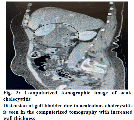 IJPS-wall-thickness