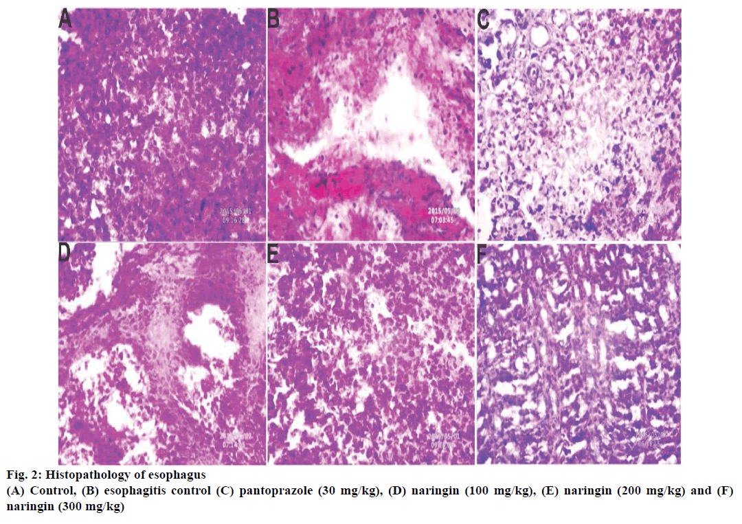 Pharmaceutical-Sciences-esophagitis-control