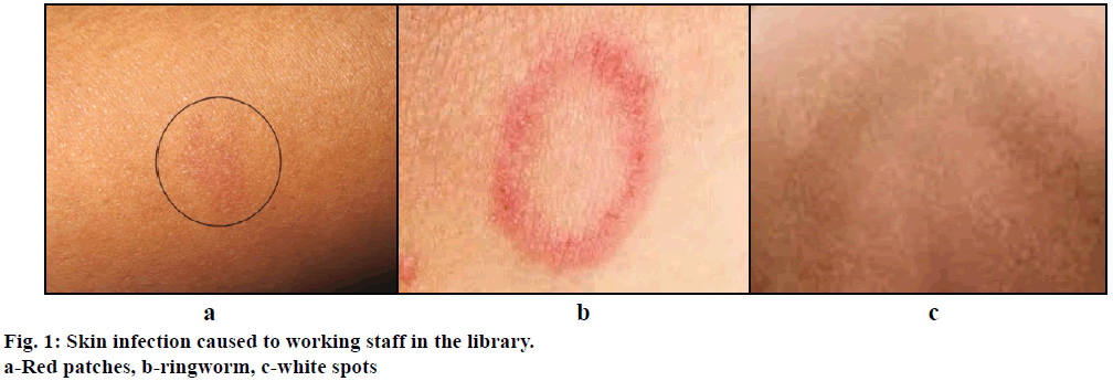 ijps-Skin-infection