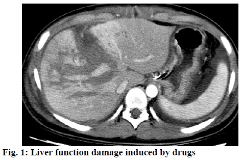 ijps-function-damage-induced