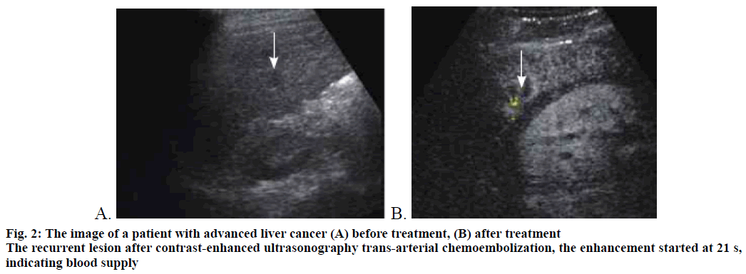 ijps-ultrasonography