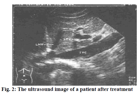 ijps-ultrasound-image