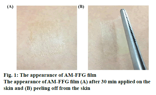 ijpsonline-am-ffg-film