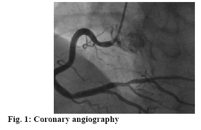 ijpsonline-angiography