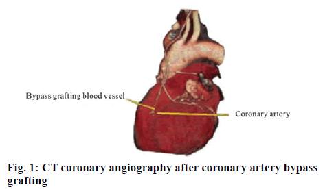 ijpsonline-angiography