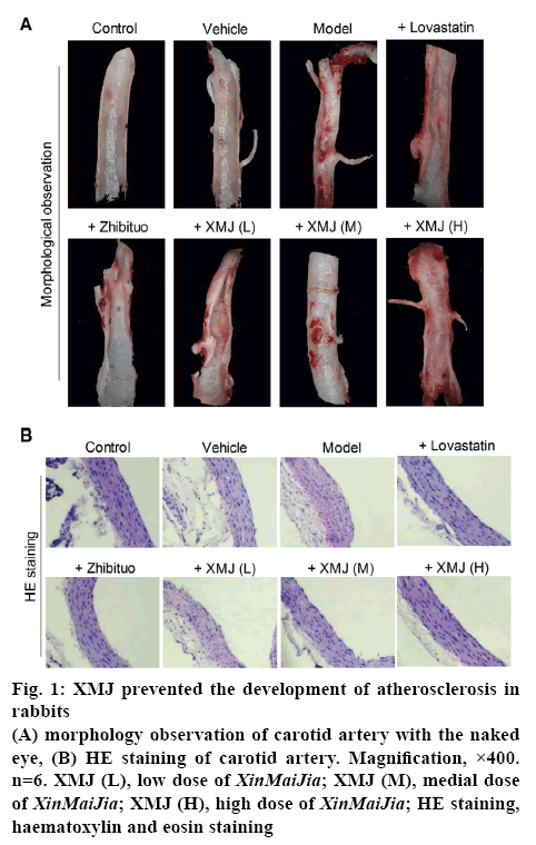 ijpsonline-atherosclerosis