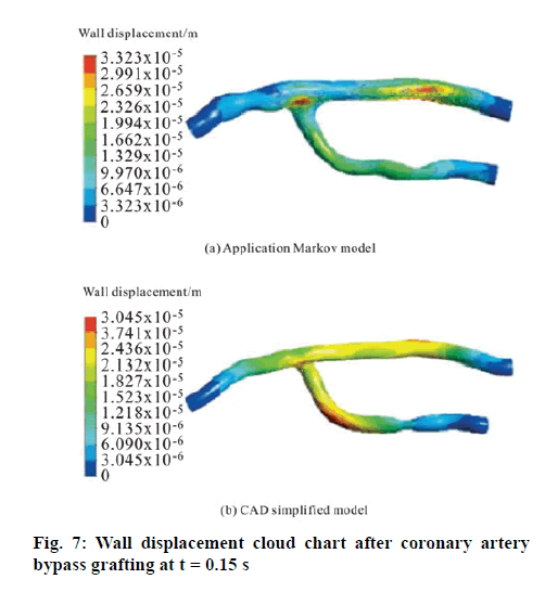 ijpsonline-coronary