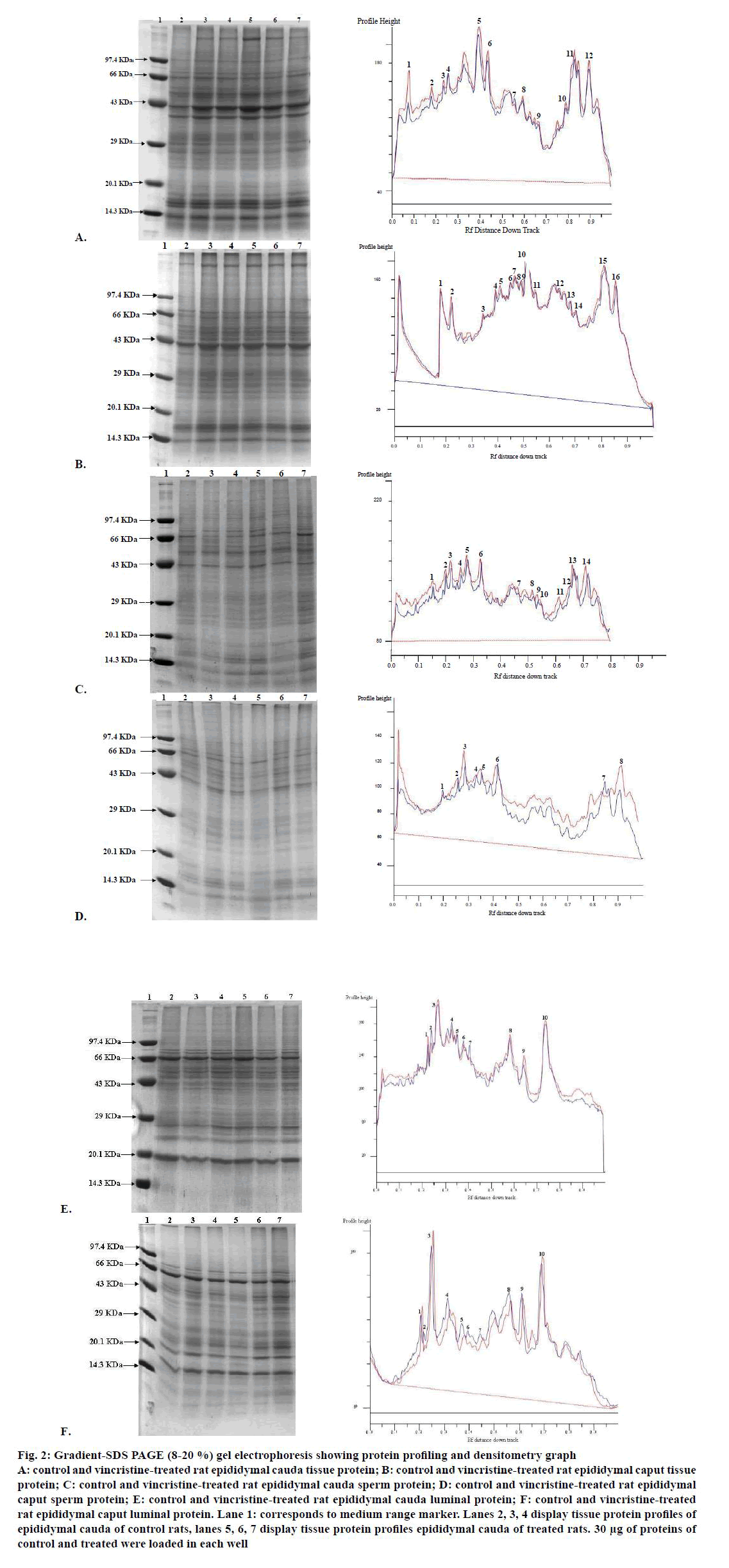 ijpsonline-densitometry-graph