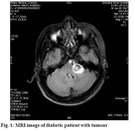 ijpsonline-diabetic