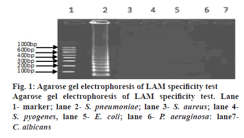 ijpsonline-electrophoresis