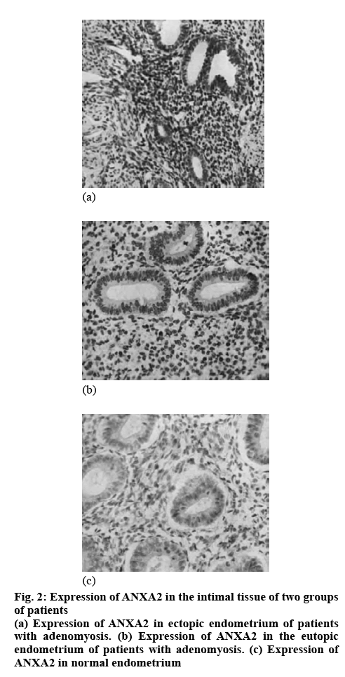 ijpsonline-endometrium