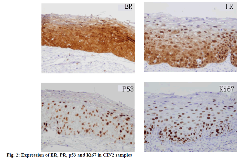 ijpsonline-expression