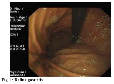 ijpsonline-gastritis