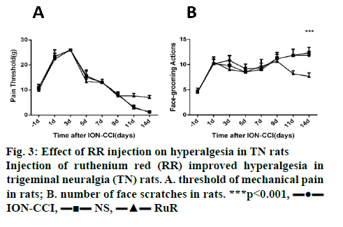 ijpsonline-hyperalgesia