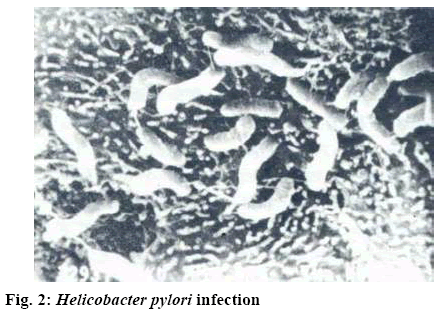 ijpsonline-infection