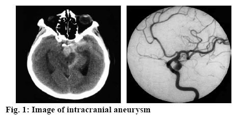 ijpsonline-intracranial