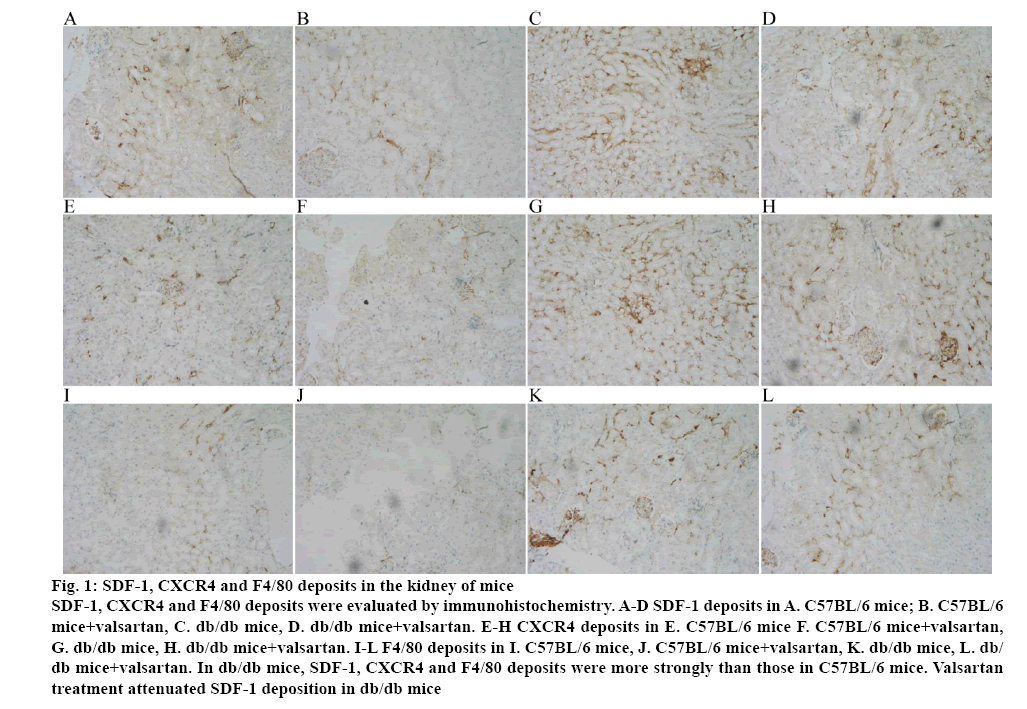 ijpsonline-kidney