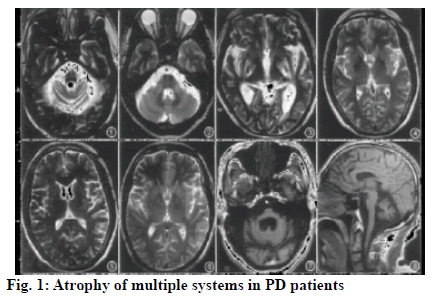 ijpsonline-multiple-systems