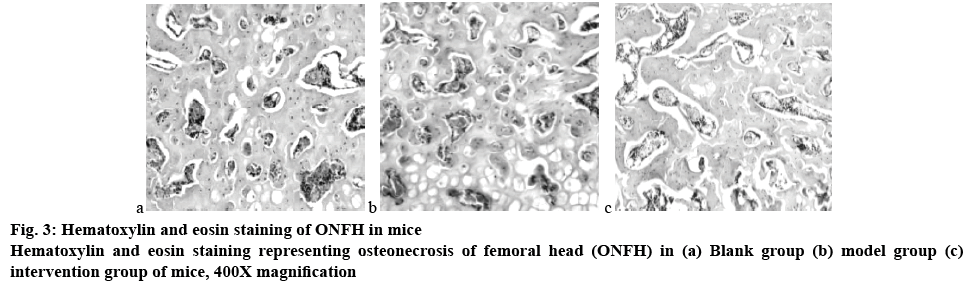 ijpsonline-osteonecrosis