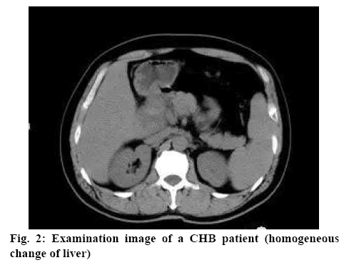 ijpsonline-patient