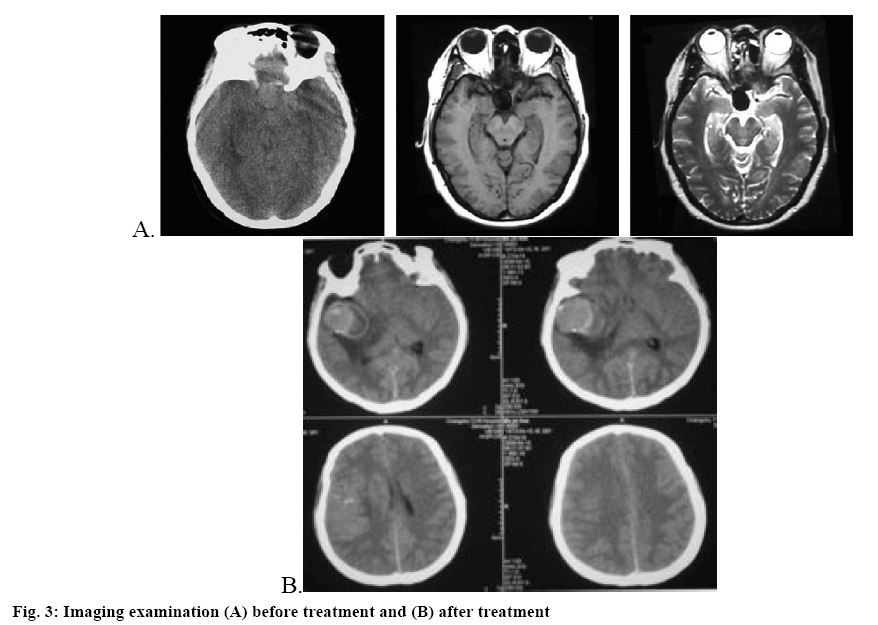 ijpsonline-treatment