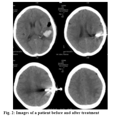 ijpsonline-treatment