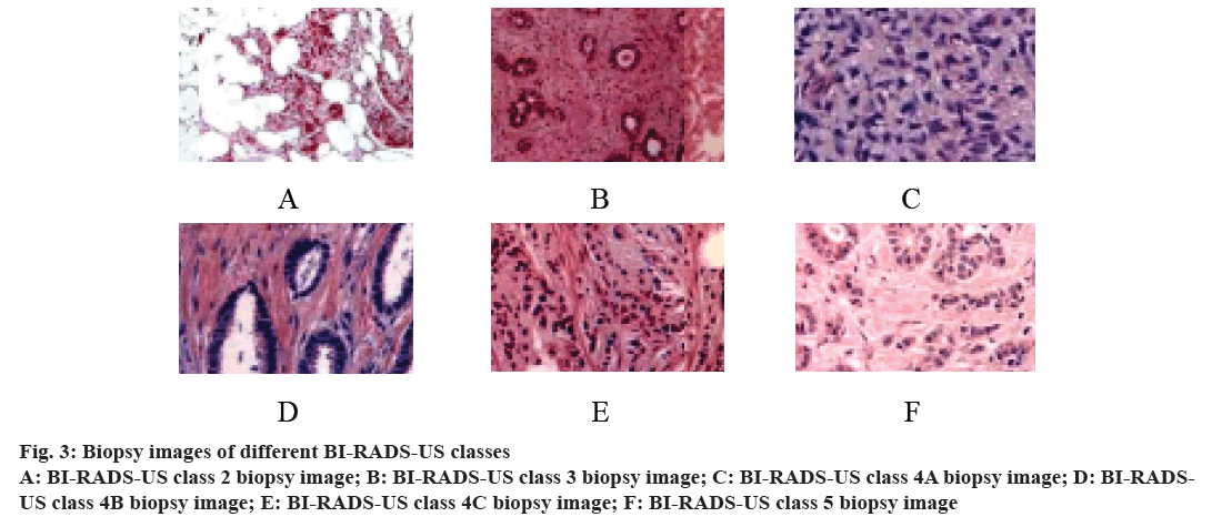 pharmaceutical-sciences-biopsy