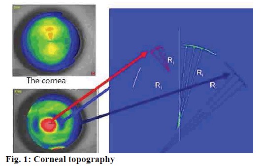 pharmaceutical-sciences-corneal-topography