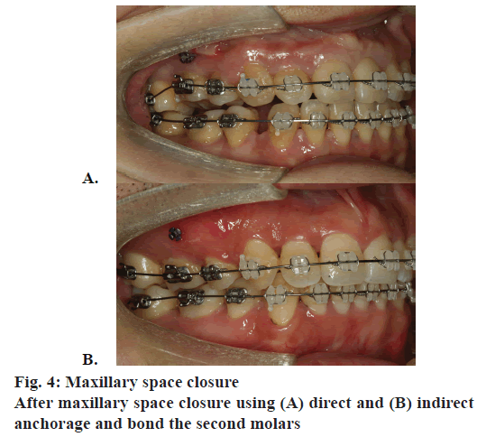 pharmaceutical-sciences-maxillary-closure